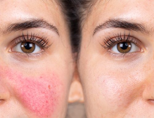 7 Ways to Protect Your Skin from Environmental Damage