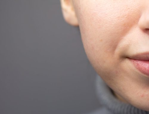 5 Signs Your Skin Barrier Needs Help (and How to Fix It)