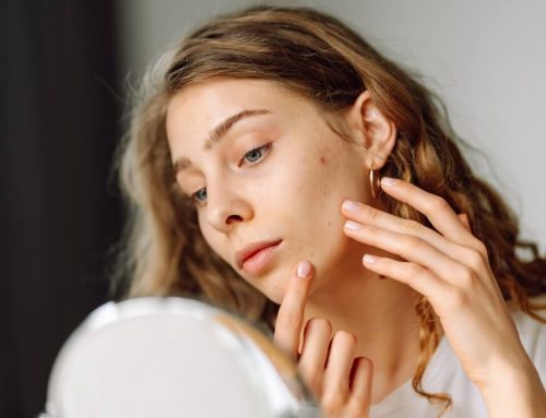 Common Skin Concerns Explained—and Where to Start